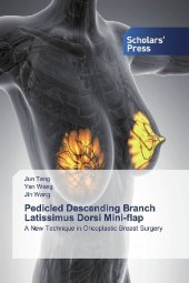 Pedicled Descending Branch Latissimus Dorsi Mini-flap: A New Technique in Oncoplastic Breast Surgery Pedicled Descending Branch Latissimus Dorsi Mini-flap: A New Technique in Oncoplastic Breast Surgery