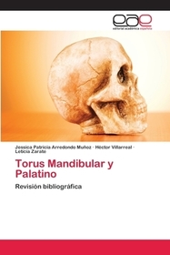 Torus Mandibular y Palatino: Revisión bibliográfica