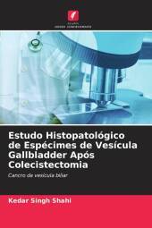 Estudo Histopatológico de Espécimes de Vesícula Gallbladder Após Colecistectomia: Cancro da vesícula biliar