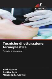 Tecniche di otturazione termoplastica: Tecniche di otturazione