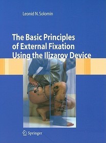 The Basic Principles of External Skeletal Fixation Using the Ilizarov Device