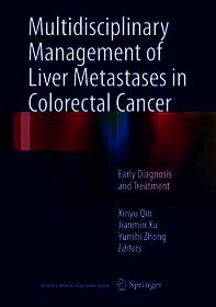 Multidisciplinary Management of Liver Metastases in Colorectal Cancer: Early Diagnosis and Treatment