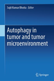 Autophagy in tumor and tumor microenvironment