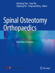 Spinal Osteotomy Orthopaedics: Deformity Correction