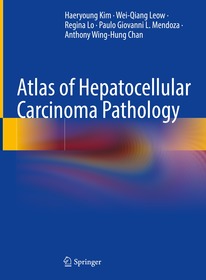 Atlas of Hepatocellular Carcinoma Pathology