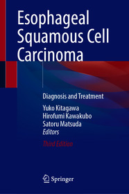 Esophageal Squamous Cell Carcinoma: Diagnosis and Treatment