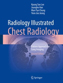 Radiology Illustrated: Chest Radiology: Pattern Approach for Lung Imaging Radiology Illustrated: Chest Radiology: Pattern Approach for Lung Imaging