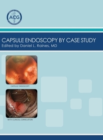 Capsule Endoscopy by Case Study, Volume 2